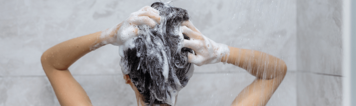 Kaip išsirinkti geriausią šampūną nuo pleiskanų?