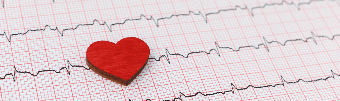 Širdies infarktas - simptomai, priežastys ir gydymas