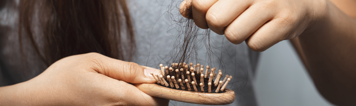 Ar plaukų slinkimas - jau nuosprendis nuplikti?