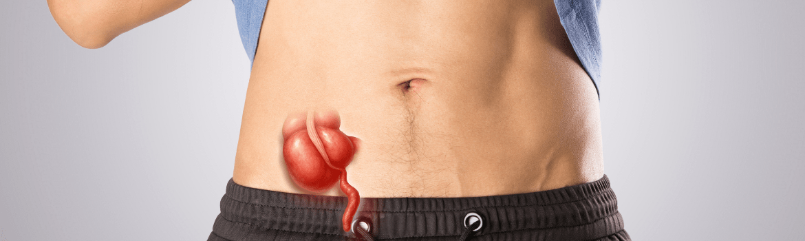 Appendicitis: how to recognize and when to see a doctor?
