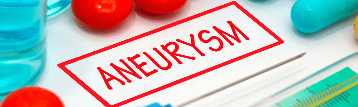 Kas yra aneurizma ir kuo ji yra pavojinga gyvybei?