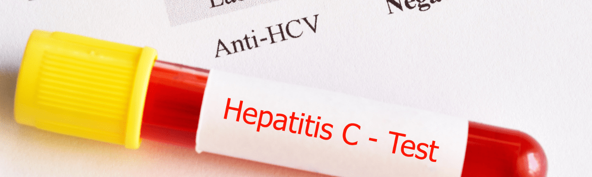 Kas yra hepatitas C ir kokią grėsmę jis kelia sveikatai?