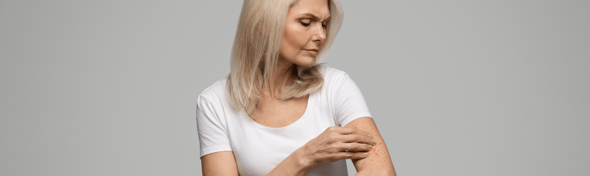 Psoriazės (žvynelinės) gydymo priemonės namuose: ar jos veikia?