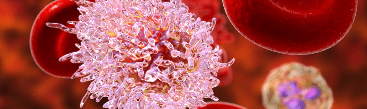 Kokiais simptomais pasireiškia leukemija?