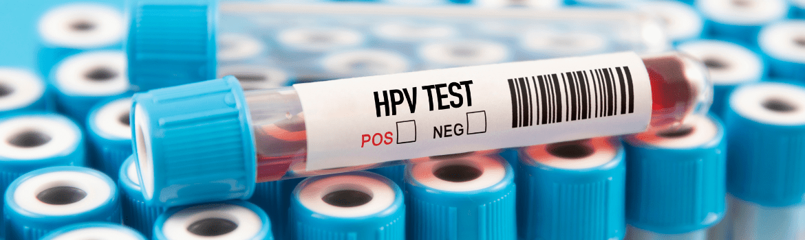 Kaip sumažinti ŽPV infekcijos riziką?