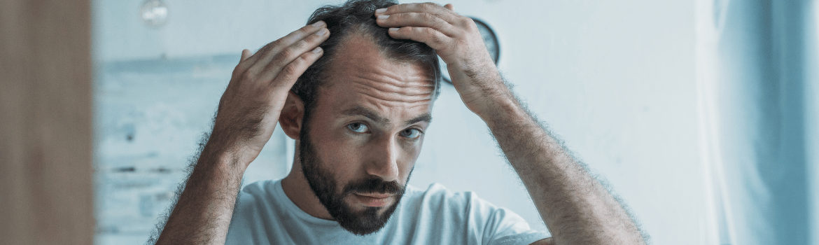 10 dalykų, kuriuos turėtumėte žinoti apie vyrų plaukų slinkimą