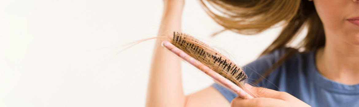 Moteriško tipo nuplikimas (androgeninė alopecija): ką turėtumėte žinoti