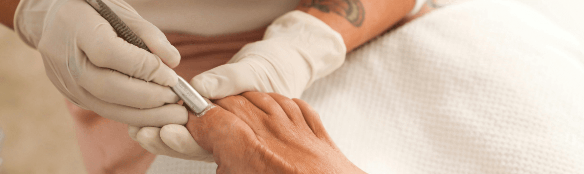 Ar kojų nagų grybelis yra diabeto požymis, ar diabetikai yra jautresni kojų nagų grybeliui?