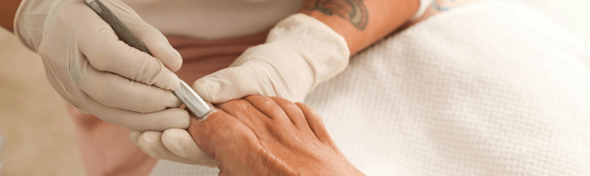 Are you having a toenail fungus? Here are some treatment options for you